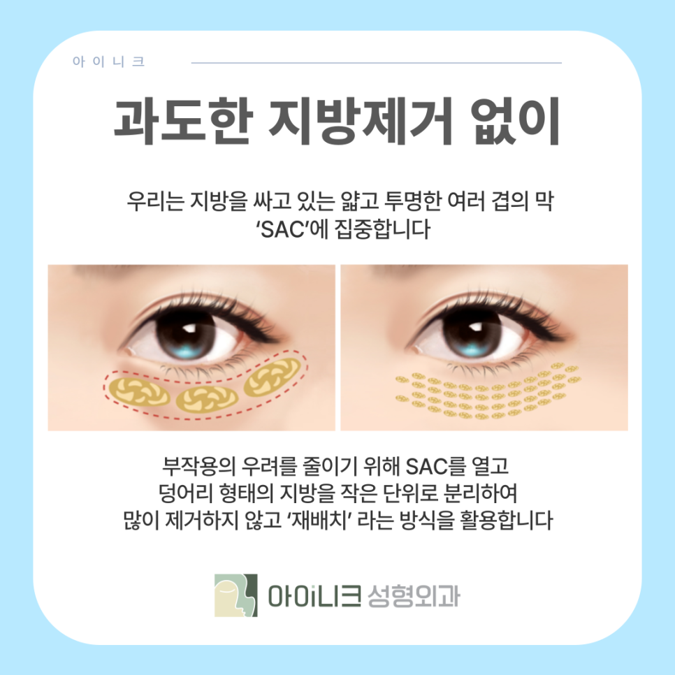 How Is Male Under-Eye Fat Removal Different from Women’s Eyes? image 8