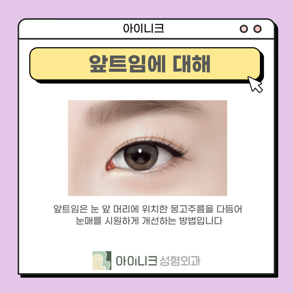 눈재수술성형외과 실패한 앞트임 재건 관련 이미지 7