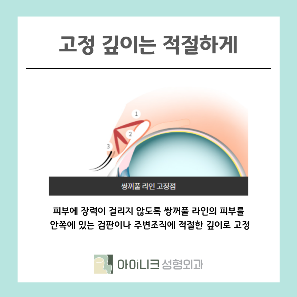 서울성형외과 속눈썹 들림 흉터가 생겼을 때 관련 이미지 10