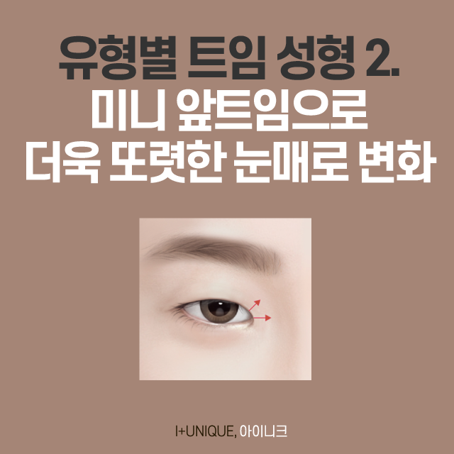 트임 성형의 종류, 그리고 트임 후기! 관련 이미지 3