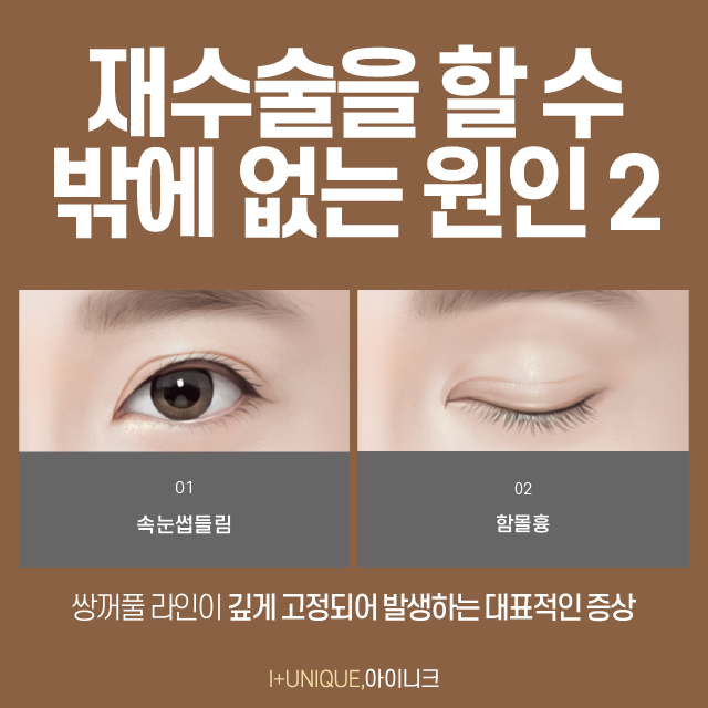 If you’re worried about uneven eyes after eye surgery, Ineek’s one-sided revision surgery is the answer! image 3