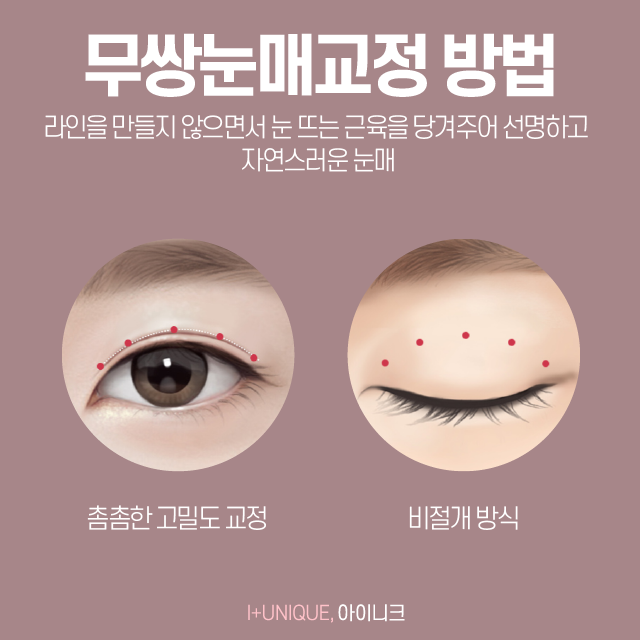 남자눈성형외과 알아보고 있다면 경력과 노하우가 있는 곳으로 관련 이미지 4