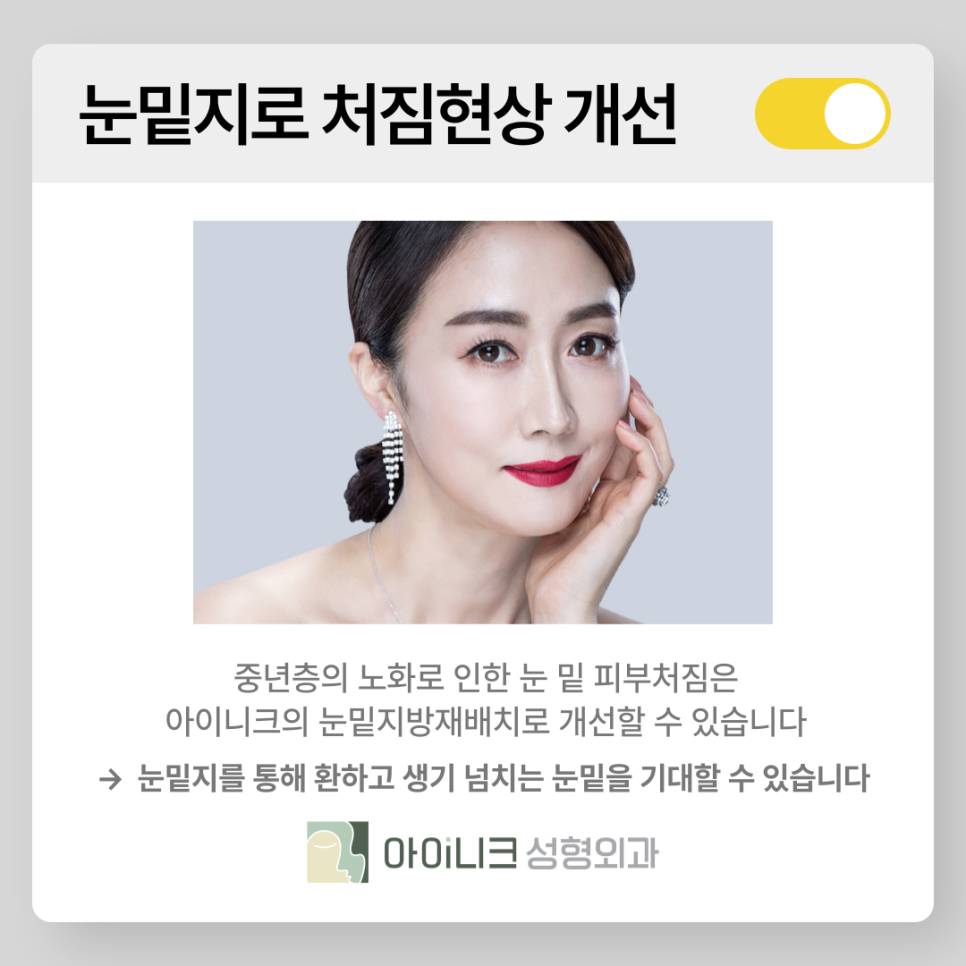 눈밑지병원 멍과 붓기가 걱정되나요? 관련 이미지 7