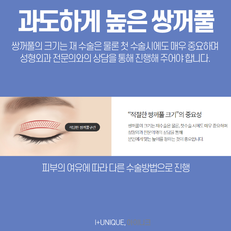 쌍꺼풀라인낮추기 방법을 알아보고 있다면 아이니크성형외과에서상담받자 관련 이미지 3