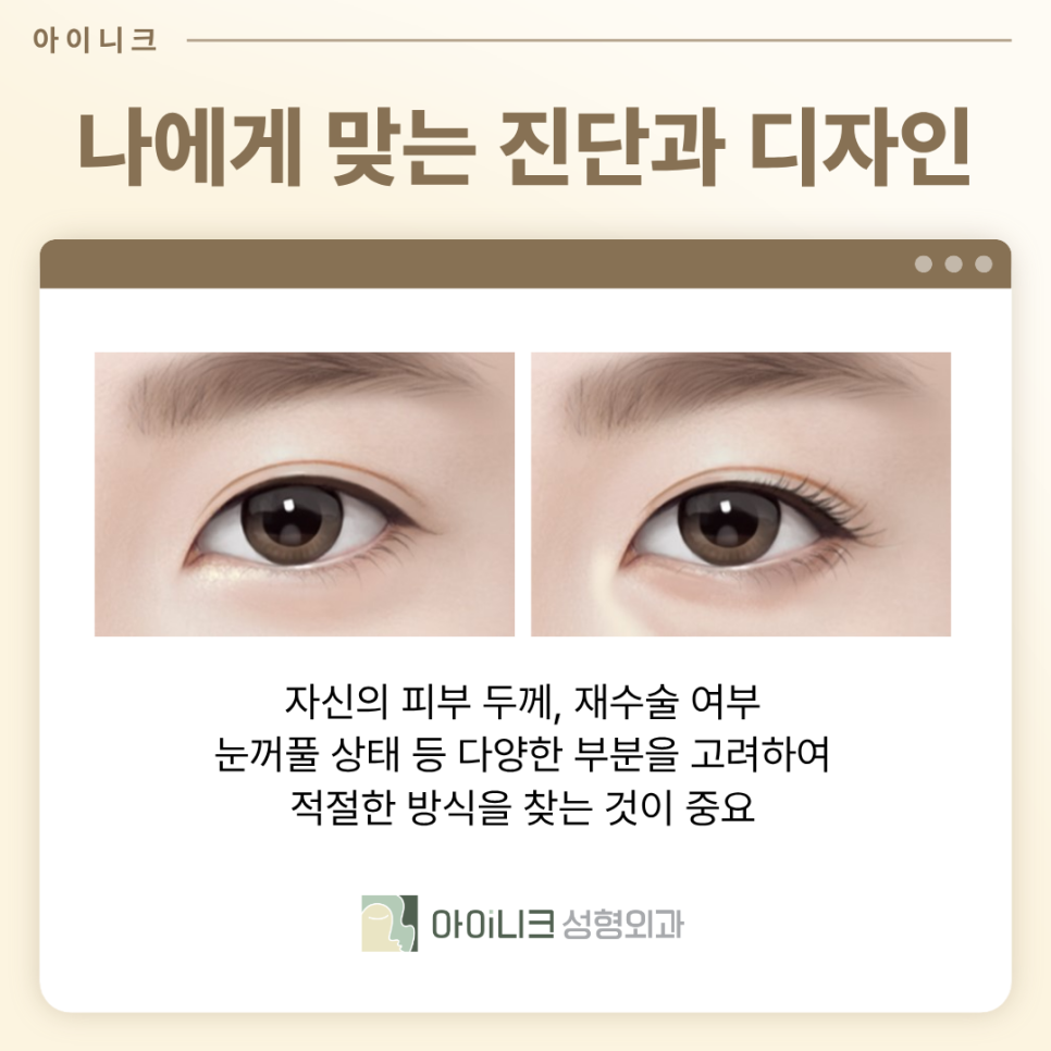 눈밑지방재배치성형외과 칙칙한 다크서클 어떻게 교정할까? 관련 이미지 8