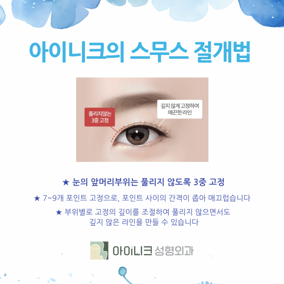 압구정쌍꺼풀 자연스럽게 예뻐지려면 관련 이미지 7