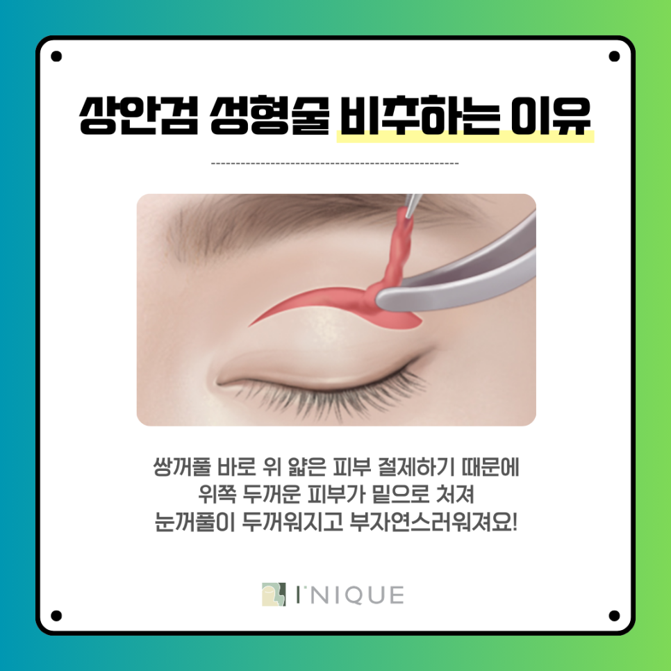 청담동 중년눈성형 정보! 상안검 비추하는 이유 관련 이미지 4