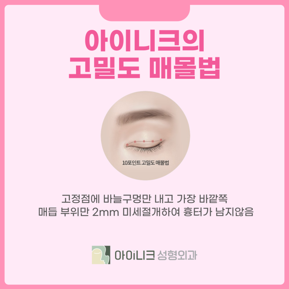 Blepharoplasty Clinic Tailored to Me in Different Ways! image 5