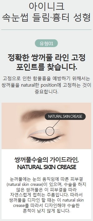 속눈썹들림 쌍수 후 흉터 개선 방법은? 관련 이미지 3