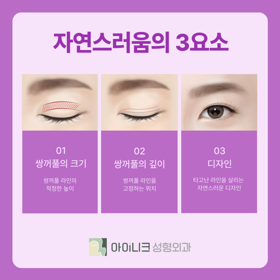 압구정 쌍꺼풀 수술 라인의 종류와 나에게 맞는 방법은? 관련 이미지 5