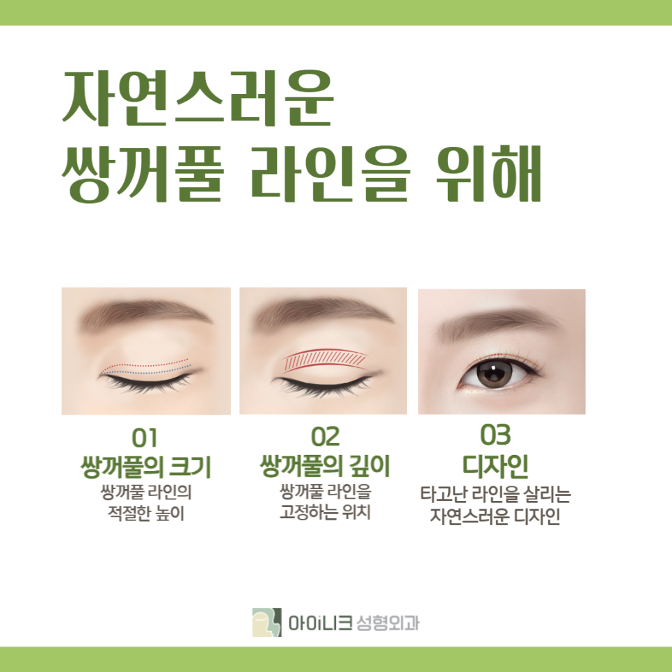 Beautifully, Without Worrying About Double Eyelid Surgery Scars image 3