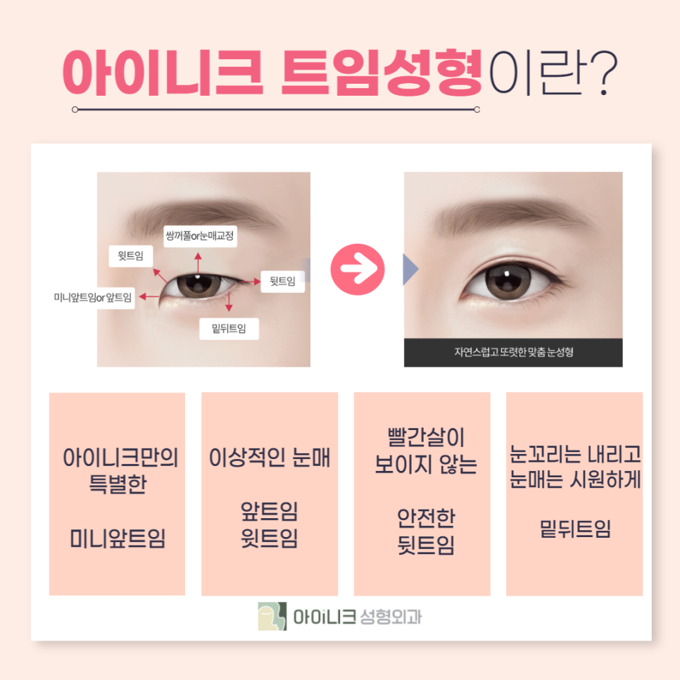 눈꼬리수술로 강아지상 만든 후기 관련 이미지 2