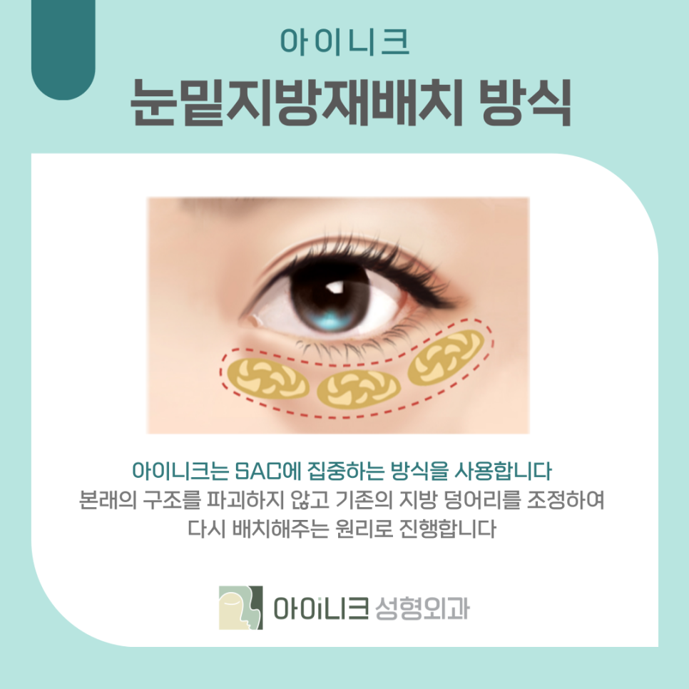 다크써클수술 어둡고 칙칙한 눈밑 개선하기 관련 이미지 12