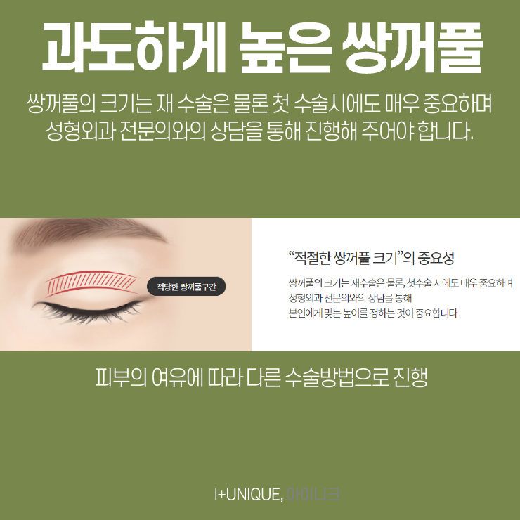 첫 수술만큼 중요한 눈재수술잘하는병원 고르기, 더이상 고민말고 아이니크로 관련 이미지 3