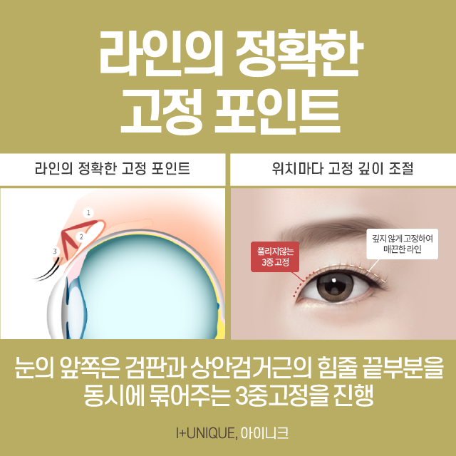 How to Create a Natural Double Eyelid! Don’t Forget These Three Things! image 4
