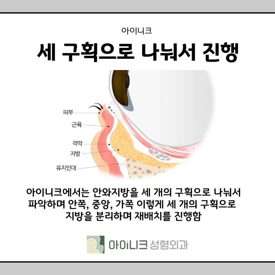 If You're Worried About Under-Eye Hollows and Bulging Dark Circles at an Under-Eye Clinic image 11