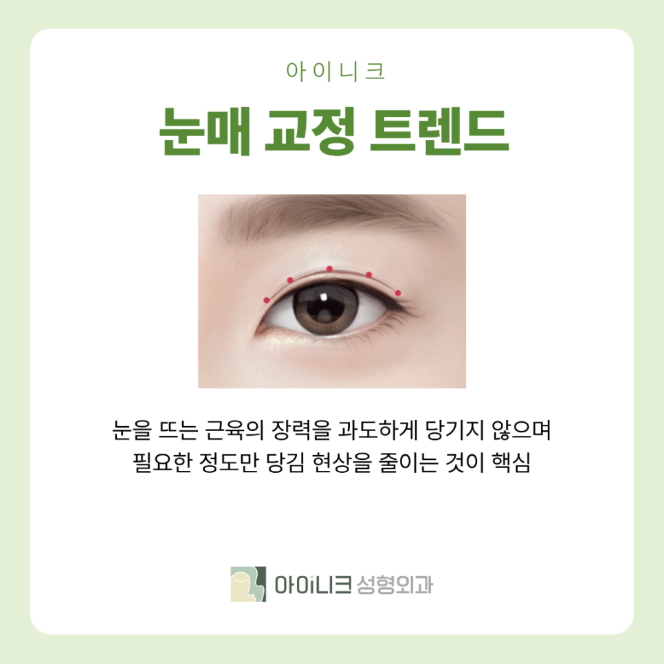 눈성형잘하는곳 2026 눈성형 트렌드는?? 관련 이미지 7