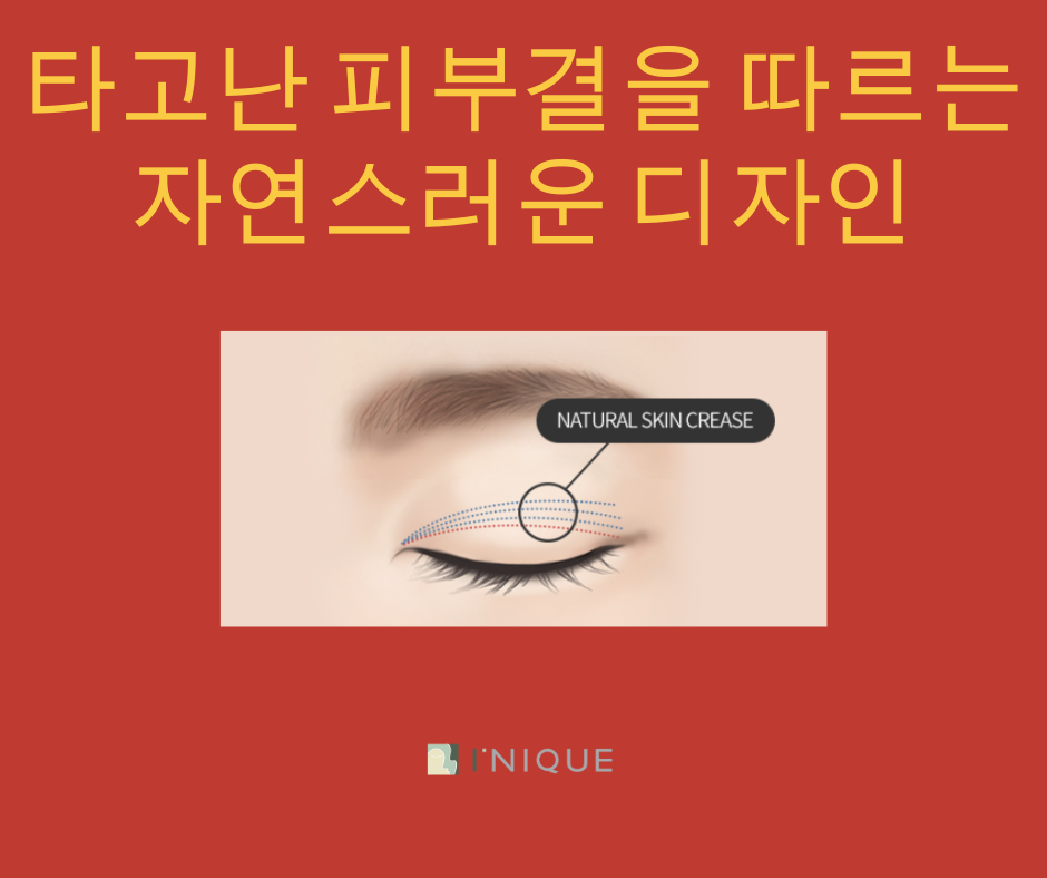 쌍꺼풀잘하는곳 찾는다면? 관련 이미지 7