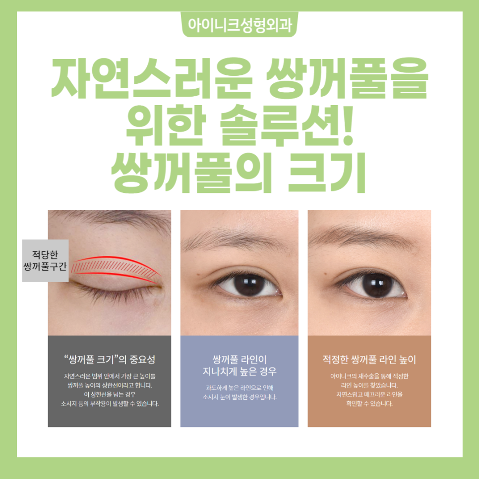 Gangnam Eyelid Surgery Recommendation: Where Is Safe and Reliable? image 2