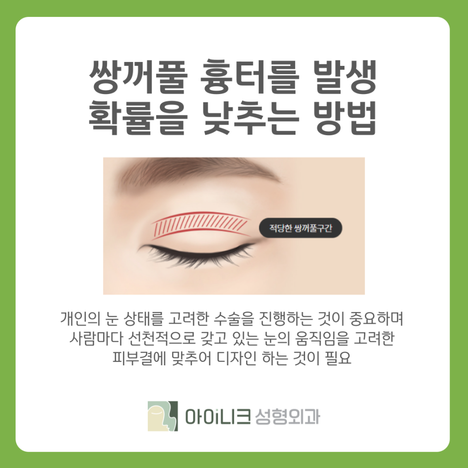 쌍꺼풀흉터 재수술 추천 원인과 해결방법 관련 이미지 7