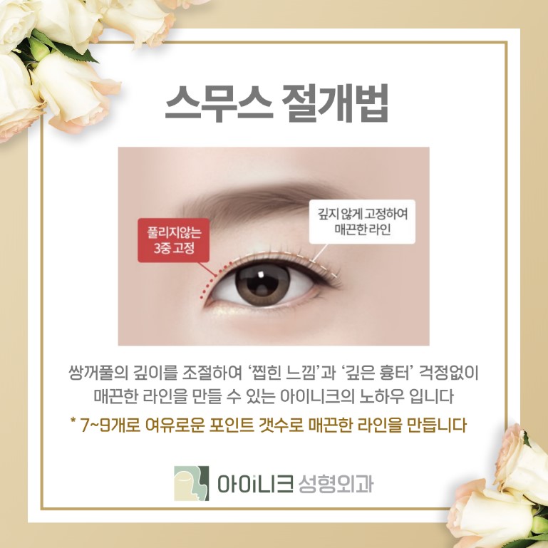 쌍꺼풀종류 자신에게 어울리는 것이 중요! 관련 이미지 12