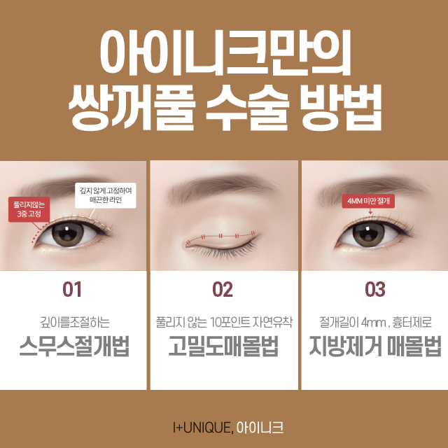 쌍꺼풀 재수술 방법 바로 알고 선택하자! 관련 이미지 5