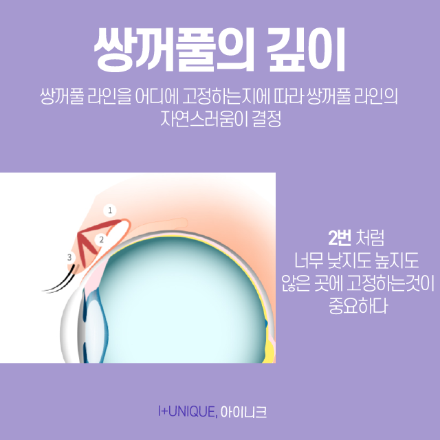 쌍꺼풀수술잘하는곳은 디테일함부터 다르다! 관련 이미지 4