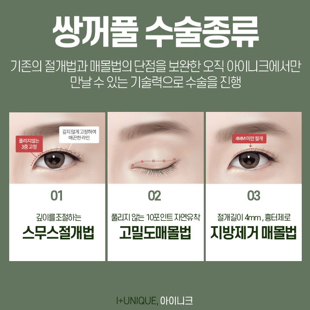 눈성형비용, 일단은 상담부터 받고 결정하자 관련 이미지 3