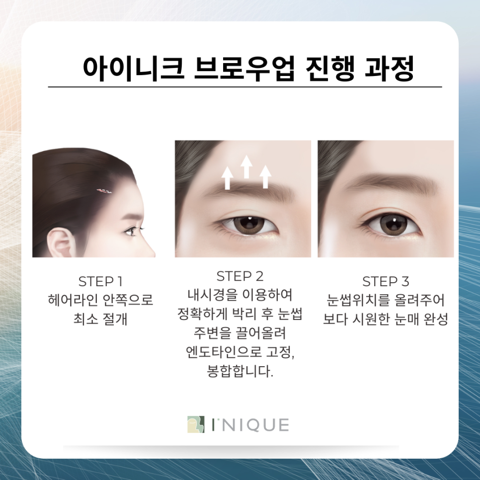브로우업으로 주름 개선, 또렷한 인상 관련 이미지 5