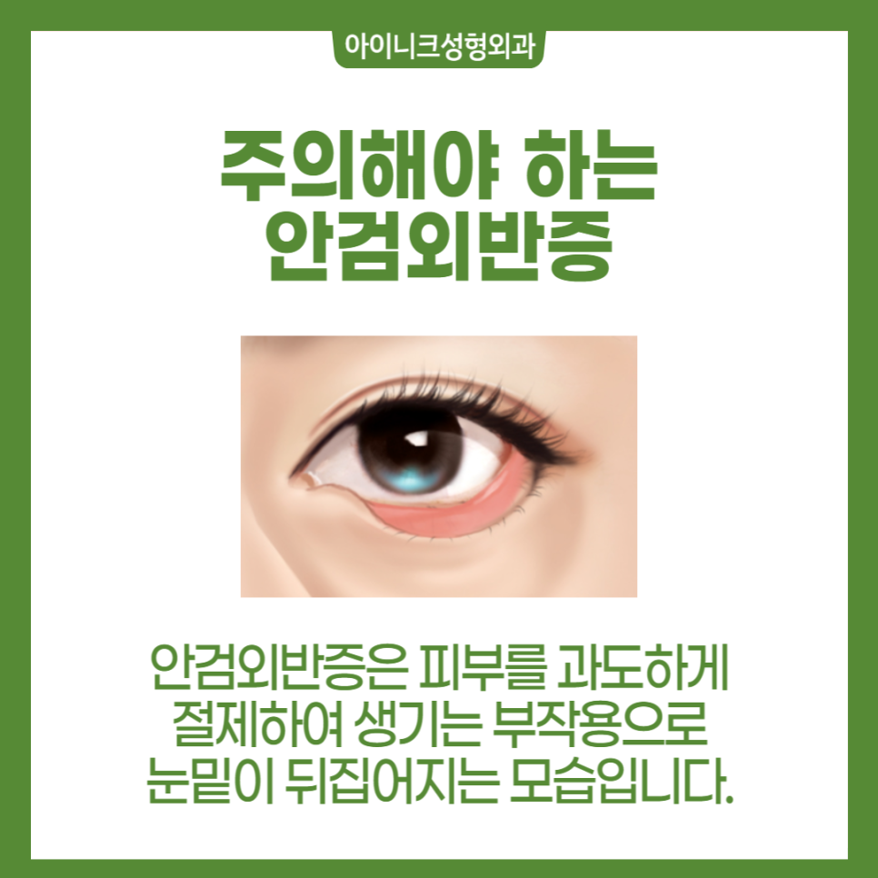 서울중년눈성형 다시 20대의 눈매로 관련 이미지 5