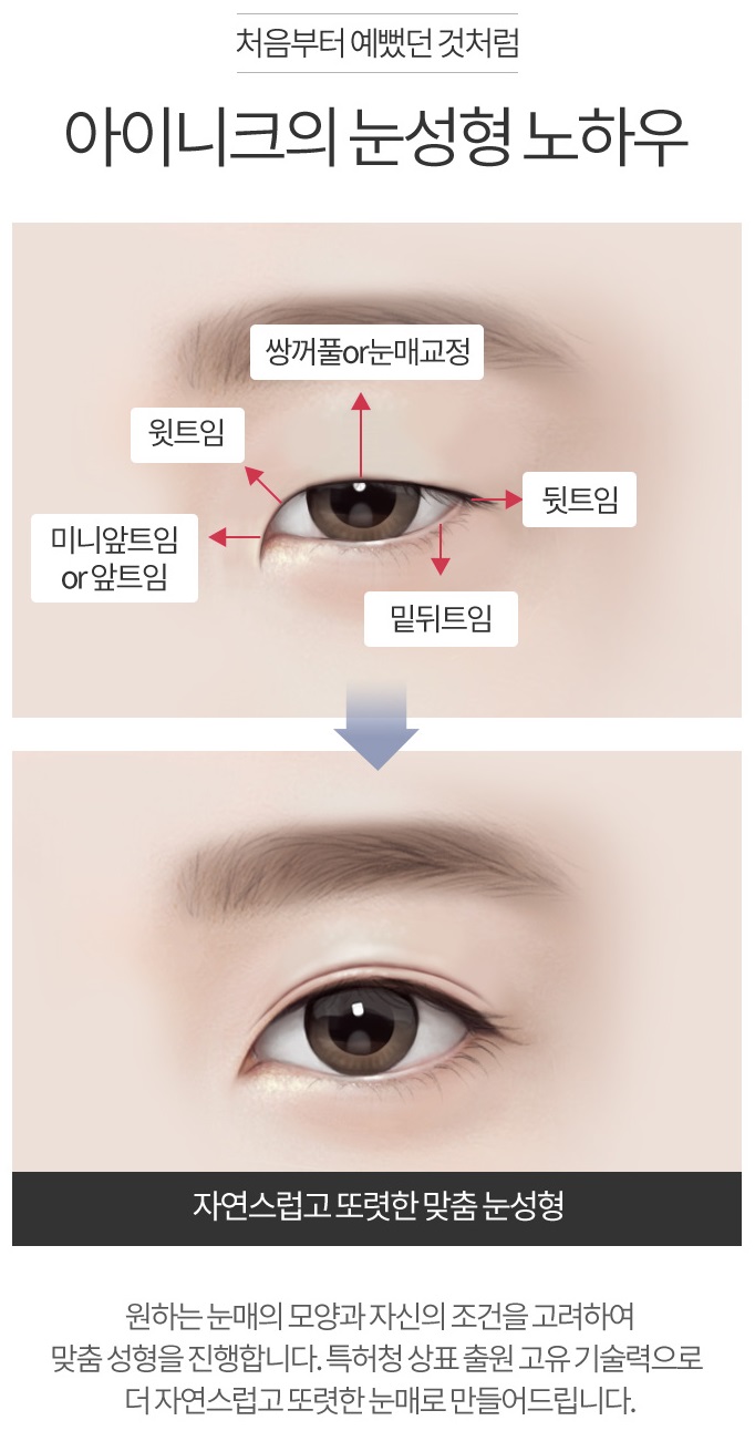 듀얼트임가격 맞춤 성형이 중요해~ 관련 이미지 3