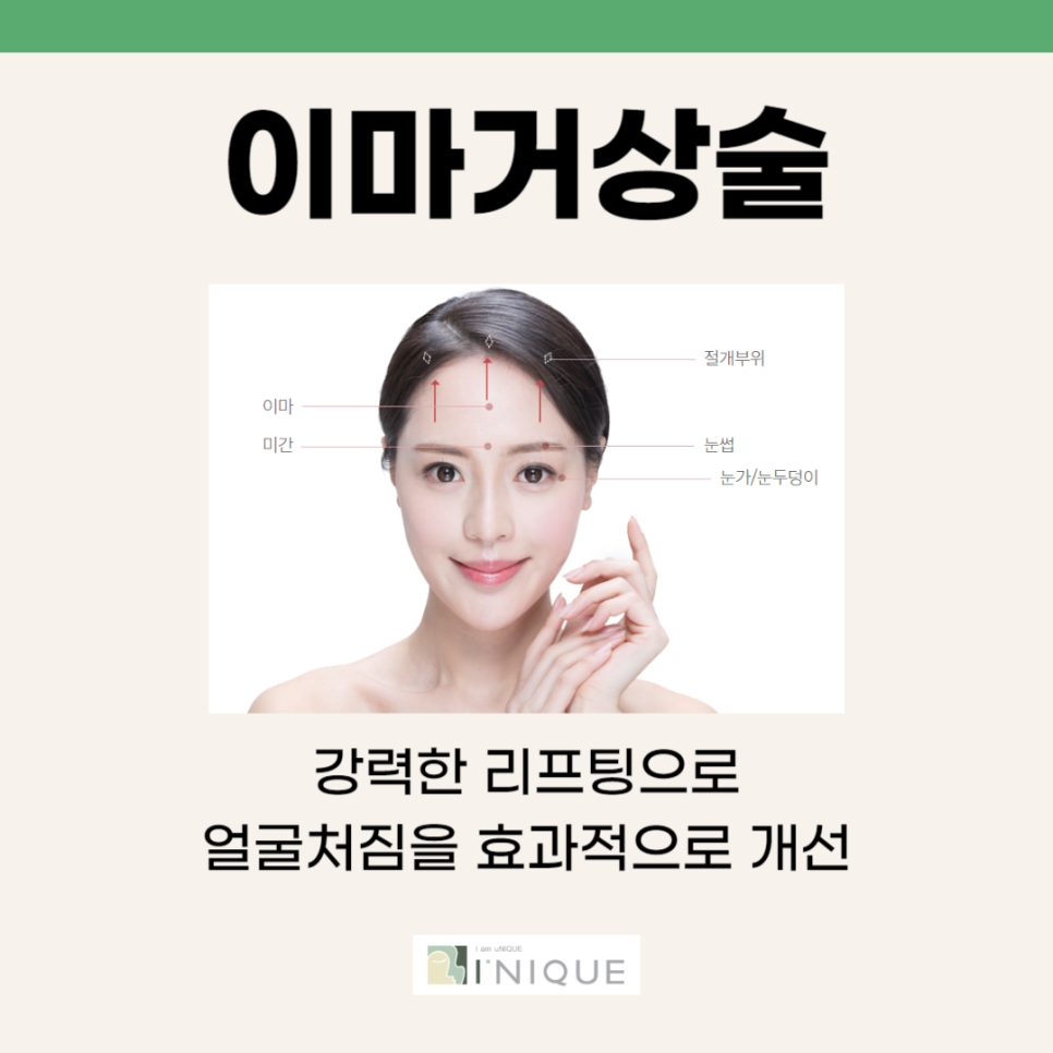 What Is an Endotine Forehead Lift? image 5