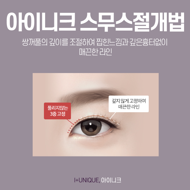 쌍커풀수술잘하는병원에서 하는 방법은 뭔가 다르다! 관련 이미지 4