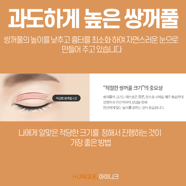 쌍꺼풀재수술병원 알아보고 있다면 경험많은 곳을 선택해야죠 관련 이미지 3
