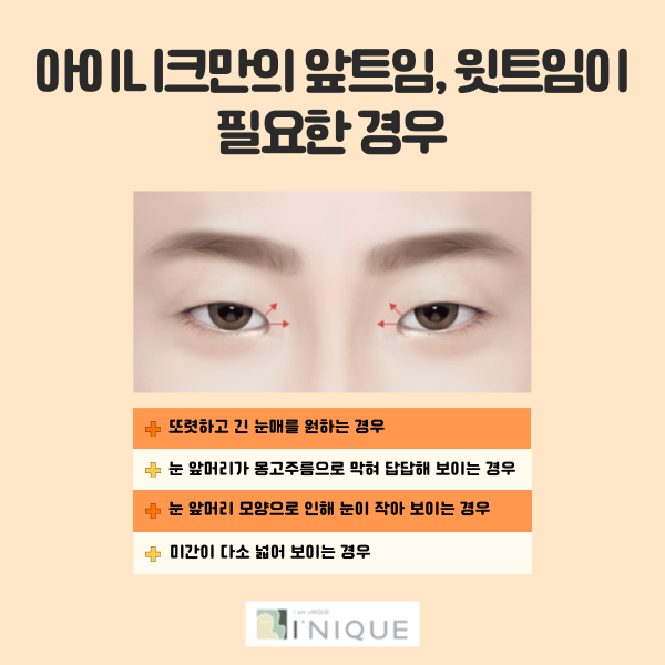 Eyelid Corner Surgery: Natural Results Are Essential! image 4