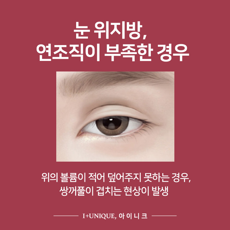 쌍꺼풀이 여러겹? 삼꺼풀 탈출하기 #2 관련 이미지 2