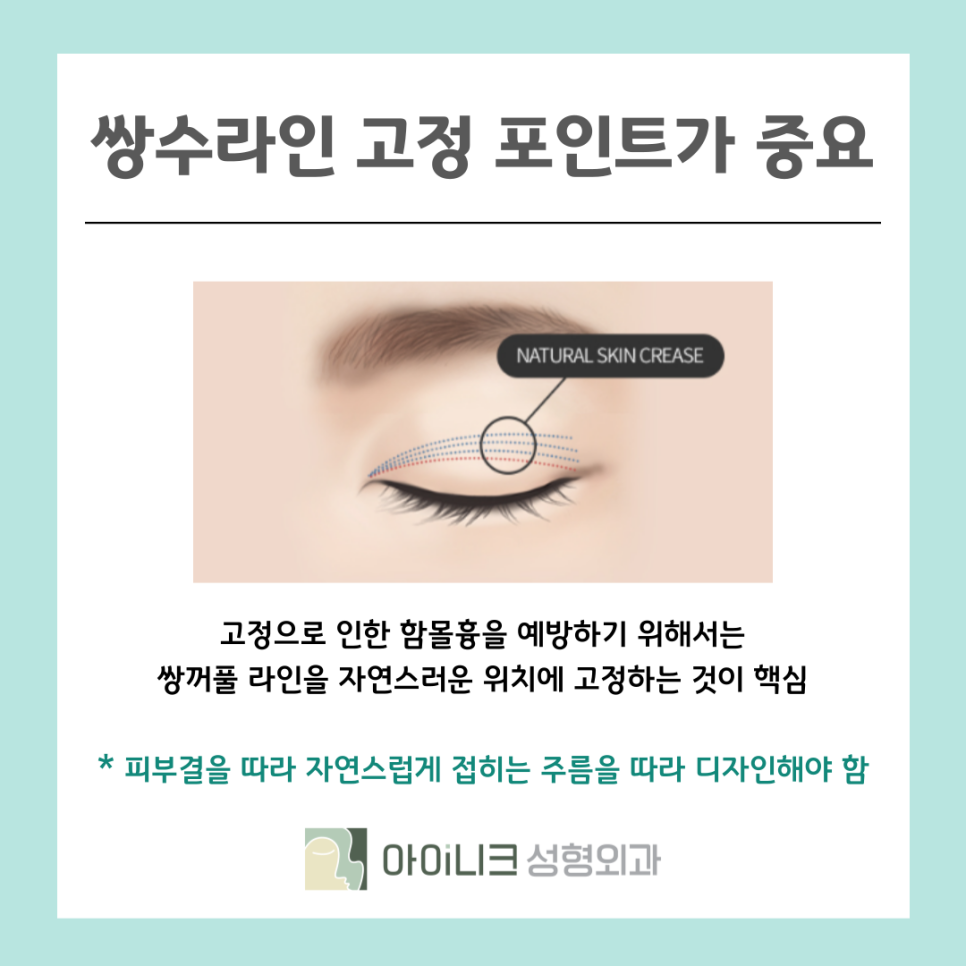 서울성형외과 속눈썹 들림 흉터가 생겼을 때 관련 이미지 9