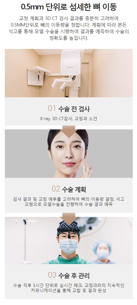 긴얼굴양악 최소 선교정으로 안전하고 확실하게! 관련 이미지 6