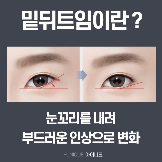 트임 성형 잘하는곳 검색하느라 지치셨죠? 아이니크로 오세요~ 관련 이미지 5