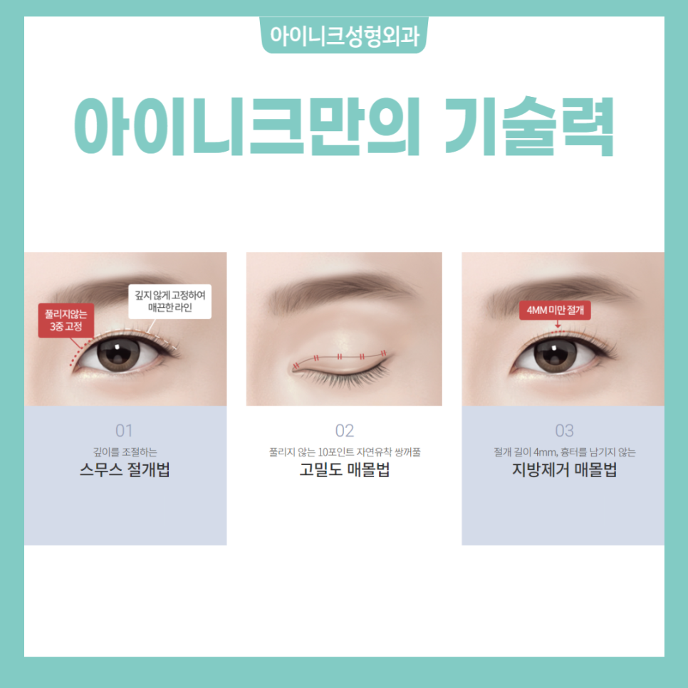 쌍꺼풀만들기 아이니크에서 알아보세요! 관련 이미지 2