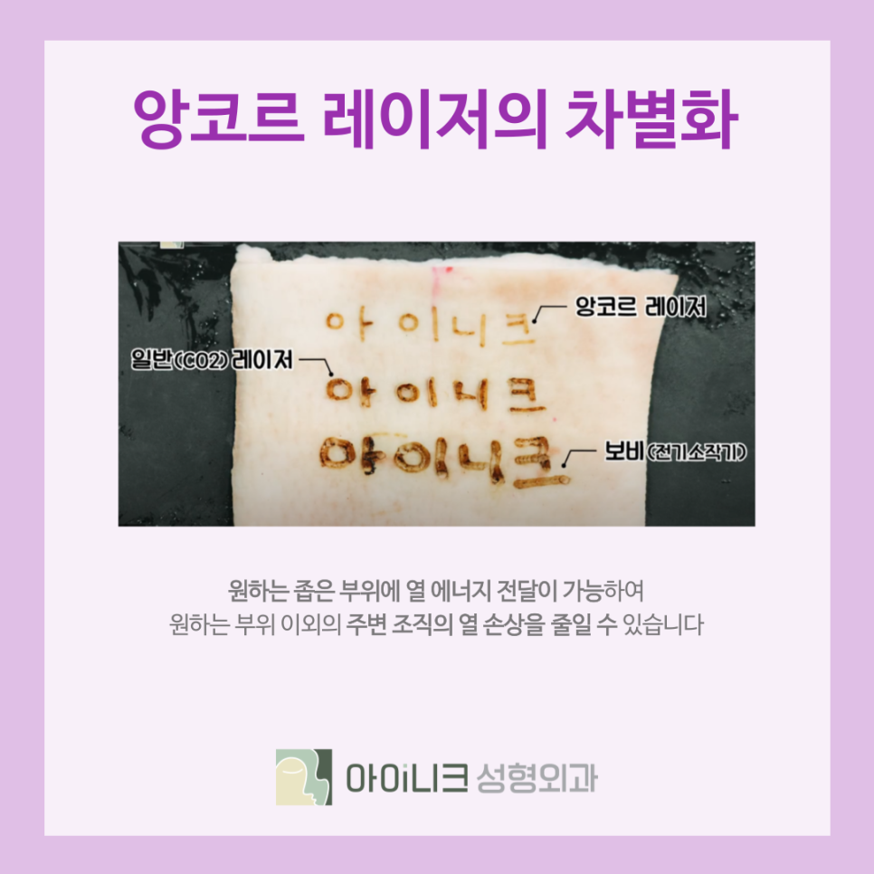 눈밑지방재배치통증 멍 붓기가 적은 아이니크의 노하우 관련 이미지 7