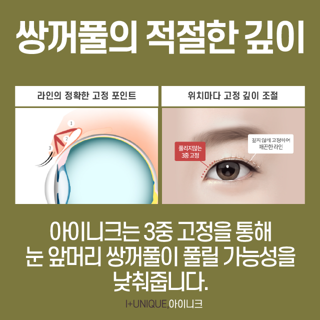 If You Want to Succeed with Gangnam Eye Surgery on Your First Operation? image 4