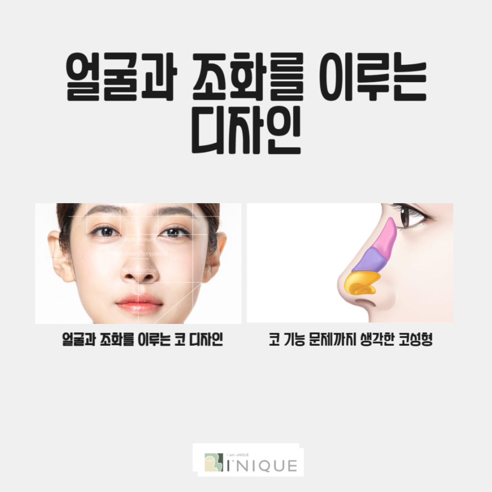 흰코성형이 고민이라면 주목! 관련 이미지 3
