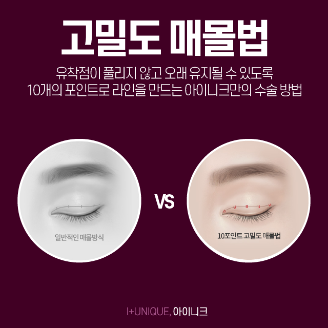 Looking for a plastic surgery clinic in Apgujeong for double eyelid surgery with no side effects? image 3