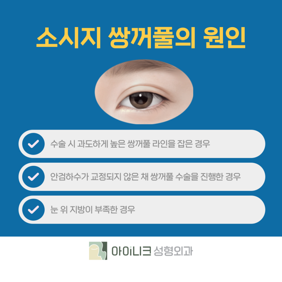 쌍수재수술비용 간편한 소시지 주사로 개선하기 관련 이미지 7