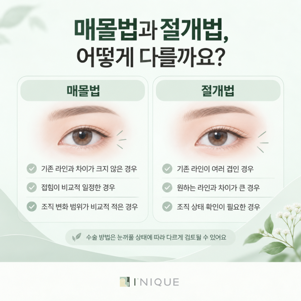 속쌍꺼풀 여자, 매몰법과 절개법은 어떻게 선택할까요? 관련 이미지 5