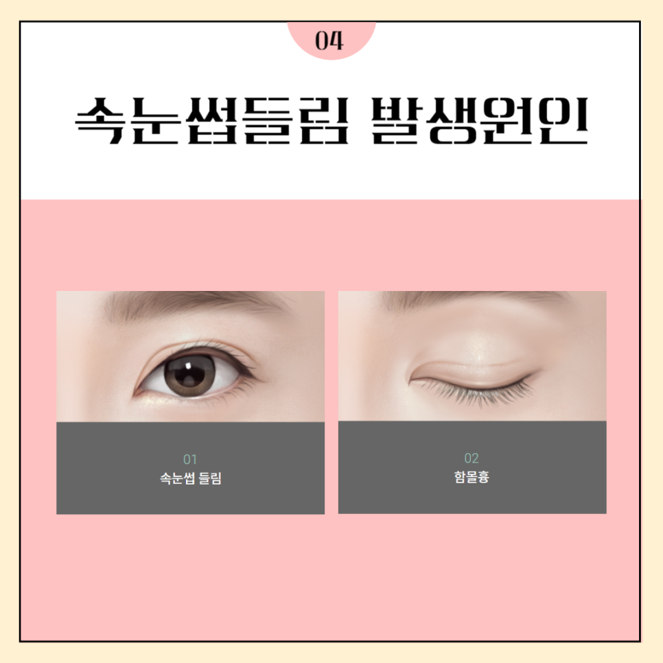 눈재수술병원 마지막이 되도록 관련 이미지 4