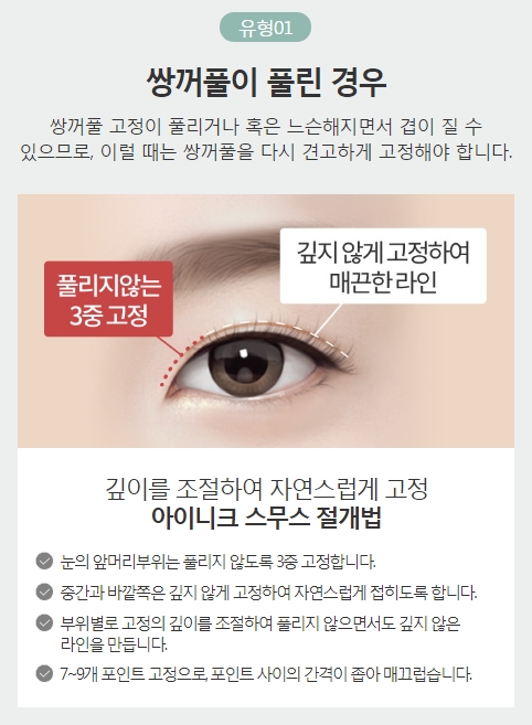 겹쌍꺼풀수술 원인별 맞춤 솔루션으로 완벽 해결! 관련 이미지 3
