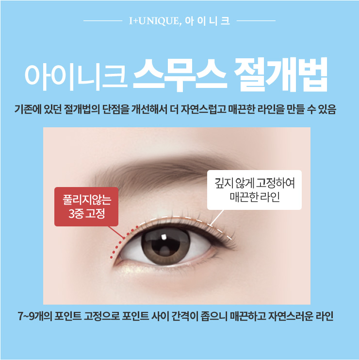 쌍꺼풀수술잘하는병원은 역시 아이니크성형외과 관련 이미지 3