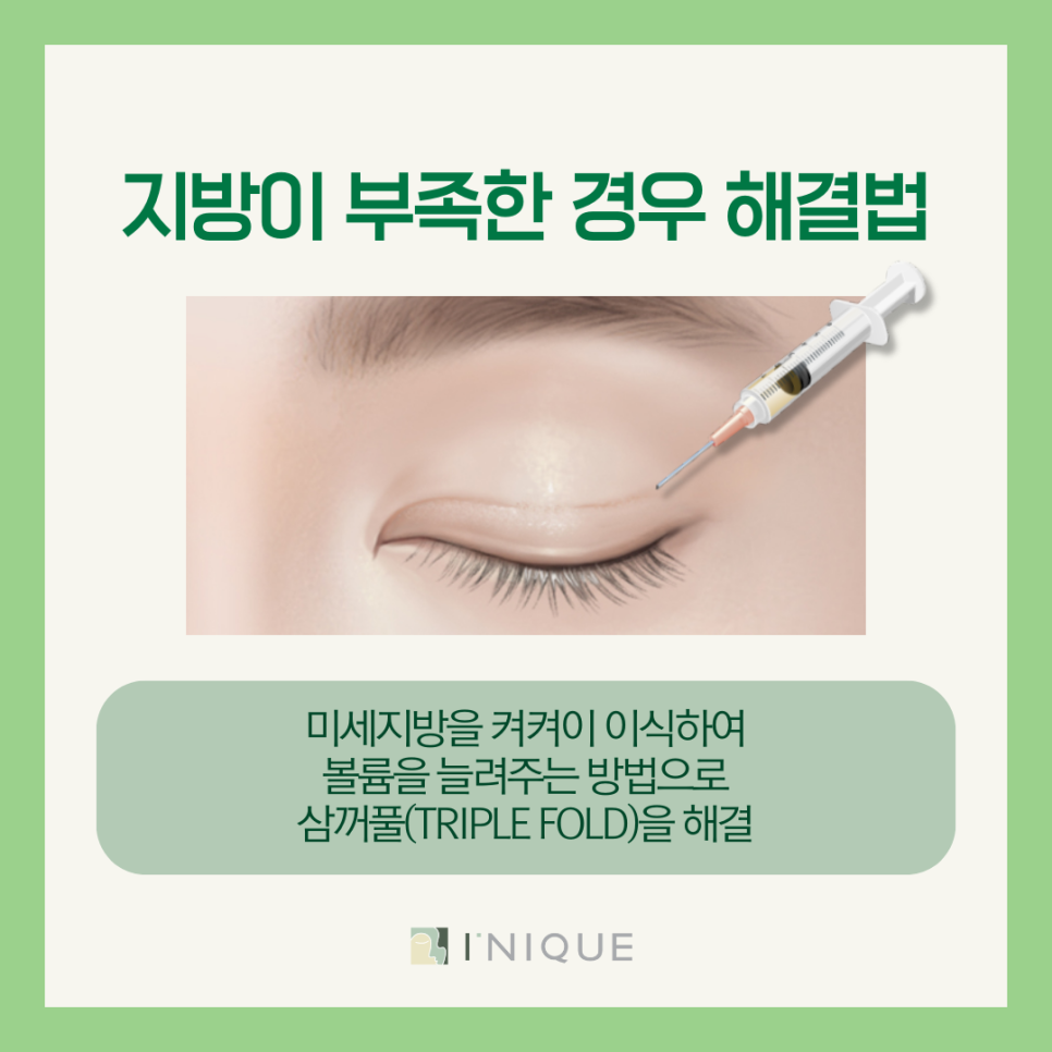 Sinsa Station Eye Revision Surgery: How Can Multiple Eyelid Folds Be Resolved? image 6